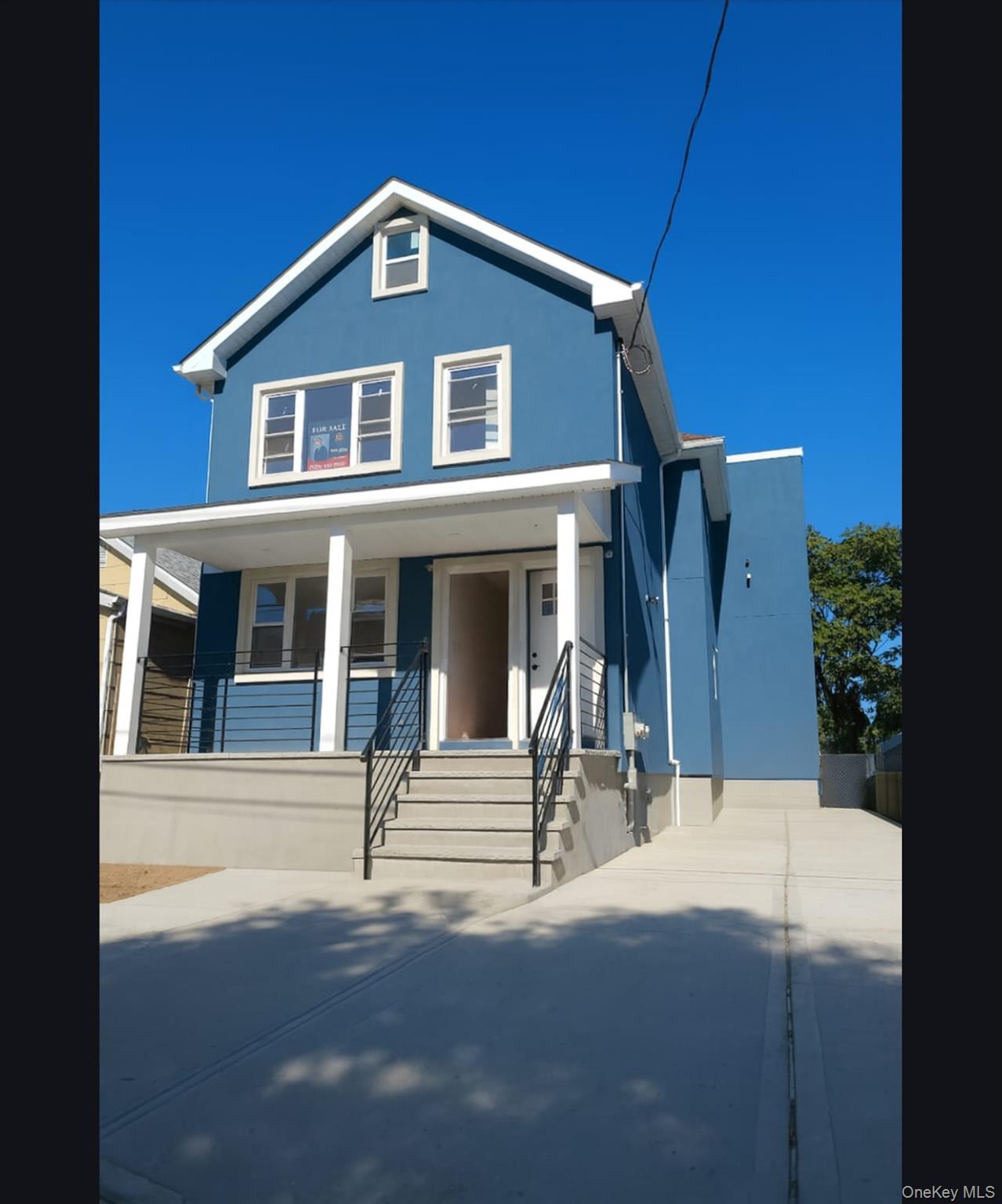 1379 East 93, Brooklyn, NY 11236